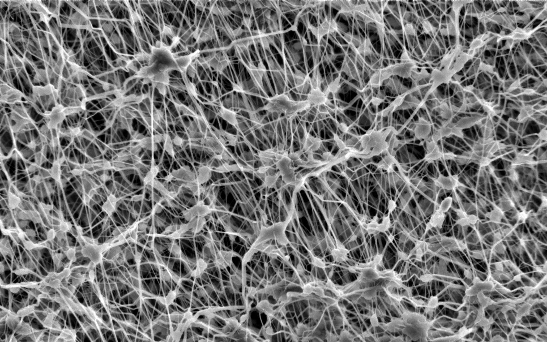 FluorTex Membrane Technology - FluorTex GmbH Polymer Technology